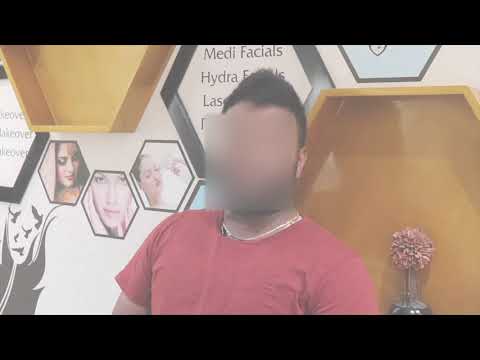 Gynecomastia Surgery - Before & After
