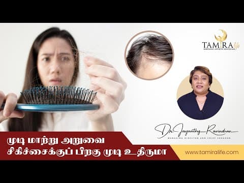 Hair Transplant - Before & After
