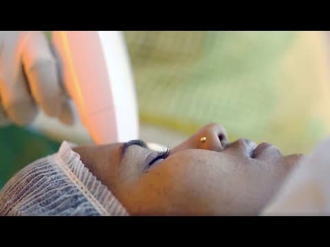 Laser Hair Removal - Before & After
