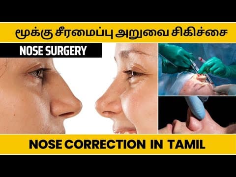 Rhinoplasty - Before & After