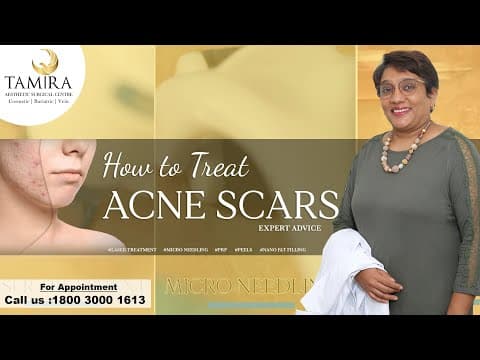 Microneedling - Before & After