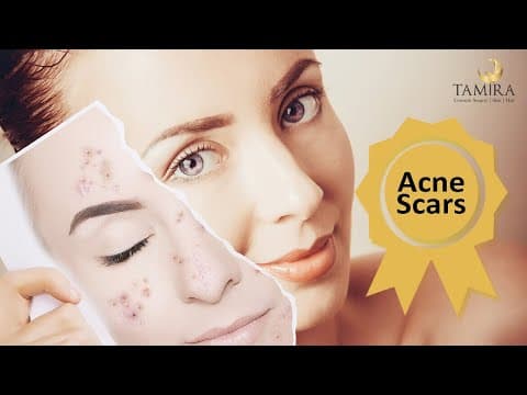Laser treatment - Feet - Before & After