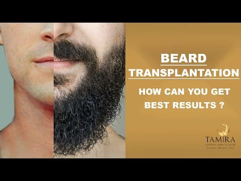 Beard Transplant - Before & After